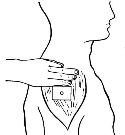 2.03 PROCEDURE FOR ADMINISTERING AN INTRAMUSCULAR INJECTION - Administer Intramuscular ...