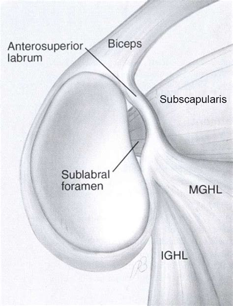 SLAP Lesion - Shoulder & Elbow - Orthobullets