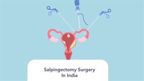 Salpingectomy Surgery Cost In India | Types & Procedure | Medsurge India