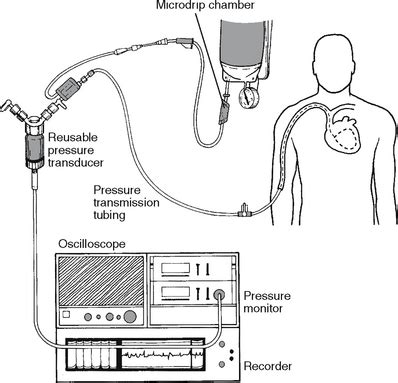 Invasive Hemodynamic Monitoring | Nurse Key