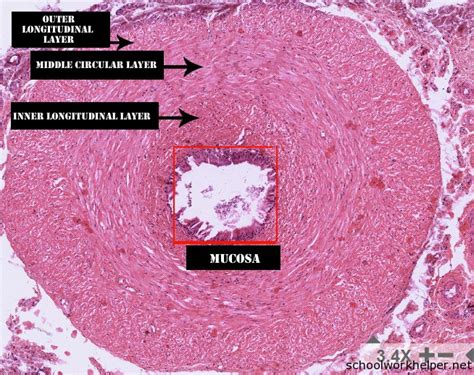 ductus-deferens-slide-labelled-histology | SchoolWorkHelper