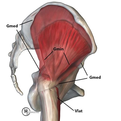 Gluteus Minimus Anatomy and Tear Patterns | Radsource