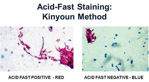 Acid Fast Staining Lab Report - KetrinenGerrett