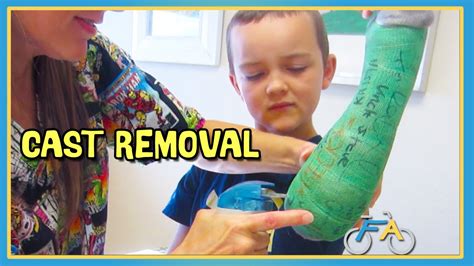 FULL ARM CAST REMOVAL - DOES IT HURT? - YouTube