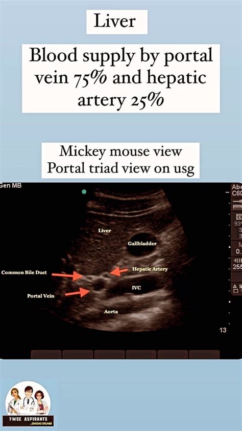 Pringle maneuver,BCS,hydatid cyst, hepatocellular carcinoma,liver x-ray : r/medicallyyours