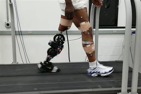 Robotic prosthetic leg uses stronger motors for better performance