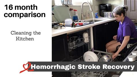 Hemorrhagic Stroke Recovery - 16 Month Comparison - YouTube