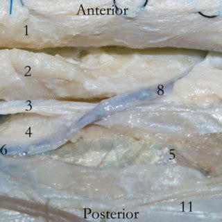 Figure. Left view of temporal region; 1. External layer of deep... | Download Scientific Diagram