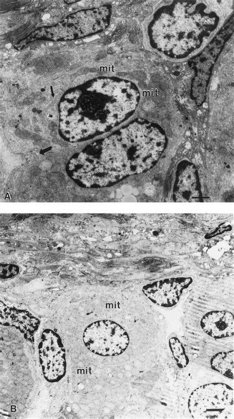 Electron micrograph of rat adrenal cortex zona glomerulosa. A, In... | Download Scientific Diagram