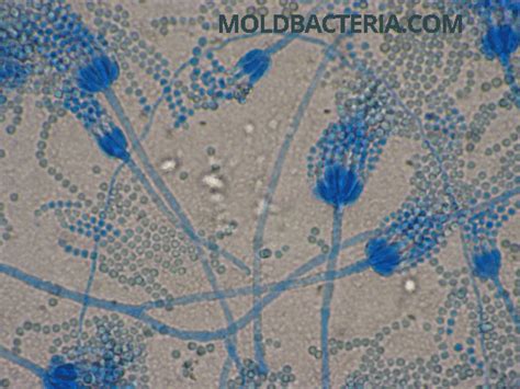 Picture of Penicillium mold under the microscope > http://www.moldbacteria.com/mold/indoor-mold ...