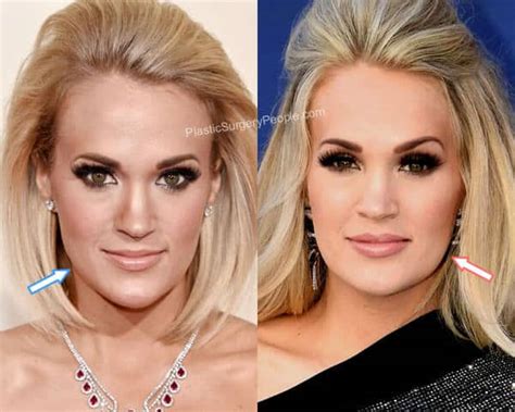 Carrie Underwood: BEFORE and AFTER