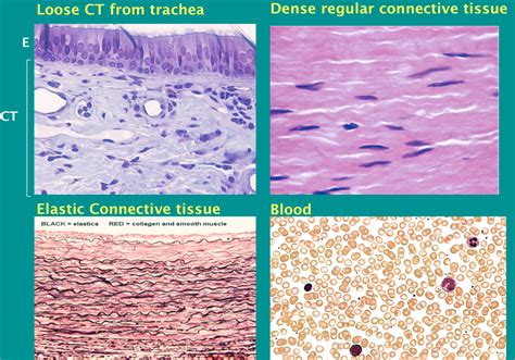 Dense Regular Connective Tissue Histology Slide Pictu - vrogue.co