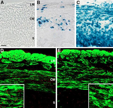 LacZ staining and immunofluorescence analyses of the uterus of ...