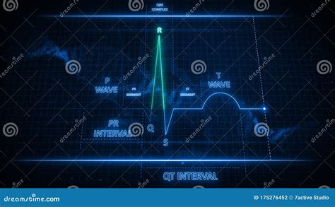 R Wave from Electrocardiogram Wave or ECG or EKG Stock Illustration ...