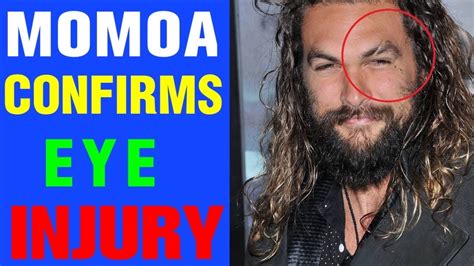 JASON MOMOA CONFIRMS EYE INJURY CAUSED BY AMBER HEARD !! - YouTube