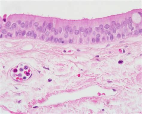 Stratified columnar epithelium - salivary gland, excretory… | Flickr