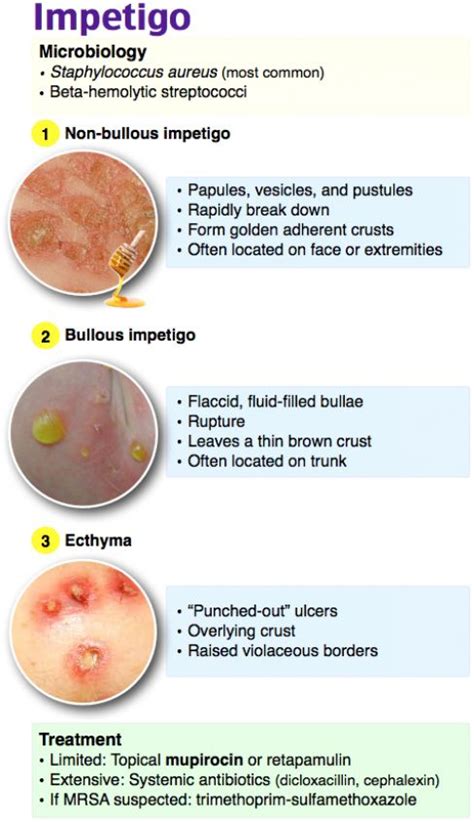 Impetigo #nursing #nursing #practioner | Pediatric nursing, Pediatric nurse practitioner ...