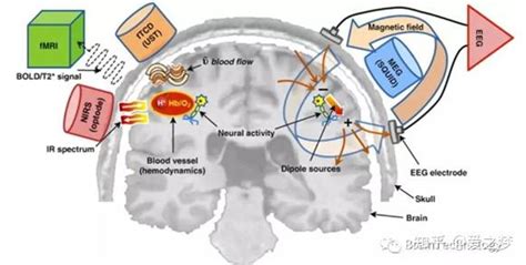 EEG VS MRI VS fMRI VS fNIRS基本简介 - 知乎