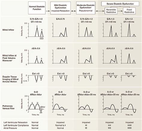 Echo assessment of Diastolic heart dysfunction simplified approach - Heart And Teeth