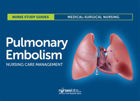 Pulmonary Embolism Nursing Care and Management: Study Guide