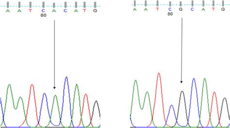 Sequencing electropherogram results (AA, GG) of the rs7520428 of... | Download Scientific Diagram