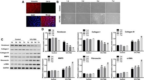 FBS induces differentiation of rabbit corneal keratocytes into ...