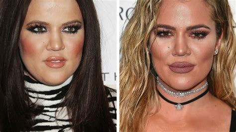 Khloe Kardashian BEFORE & AFTER 32 YEAR TIME LAPSE - YouTube