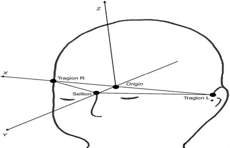 Plagiocephaly Severity Scale to Aid in Clinical Treatment Re ...