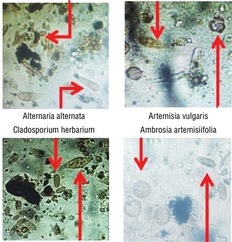 Spores of mold fungi Alternaria, Cladosporium and pollen grains of ...