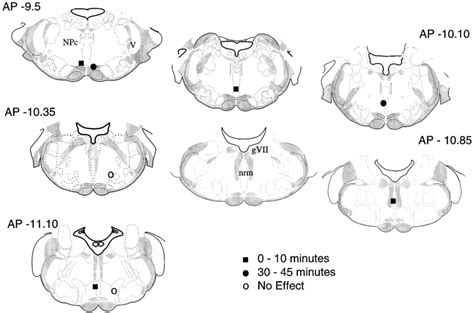 Location of muscimol injections in the nucleus raphe magnus ...