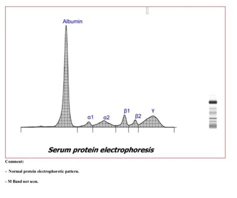 Serum Protein Electrophoresis: Introduction, Pattern, Application