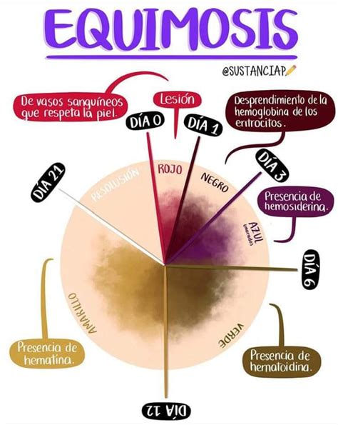 Equimosis Y Hematoma