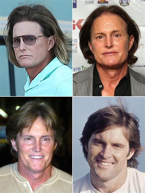 [PICS] Bruce Jenner’s Plastic Surgery — A Scary Facial Transformation – Hollywood Life