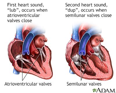 Heart palpitations