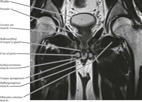 Pelvic Muscle Anatomy Mri