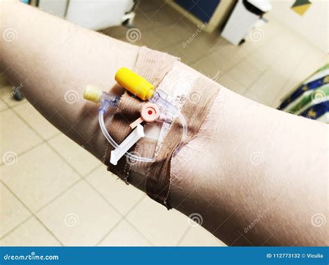 Modern Peripheral Venous Catheter For Intravenous Infusion On Female ...