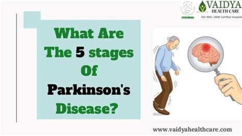 Stages Of Parkinson Disease