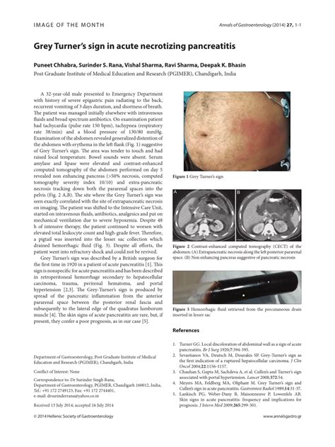 (PDF) Grey Turner's sign in acute necrotizing pancreatitis