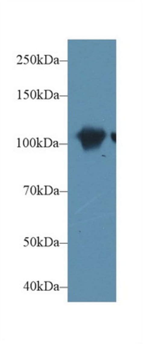 alpha Actinin 2 Polyclonal Antibody, Invitrogen 20 μL; Unconjugated:Antibodies, | Fisher Scientific