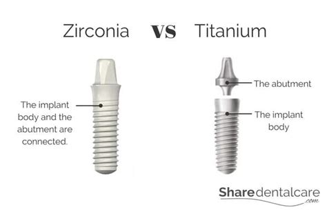 Zirconia vs Titanium Implants: The Differences - Zeramex USA