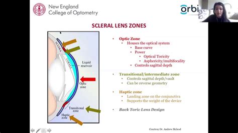 Scleral Lens Assessment and Fitting - YouTube