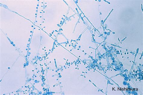 Trichophyton tonsurans microscopy-3