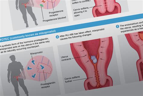 How Medication Abortion with RU-486/Mifepristone Works | Scientific American