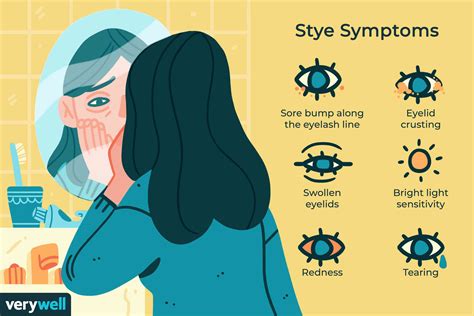 Stye: Signs, Symptoms and Complications