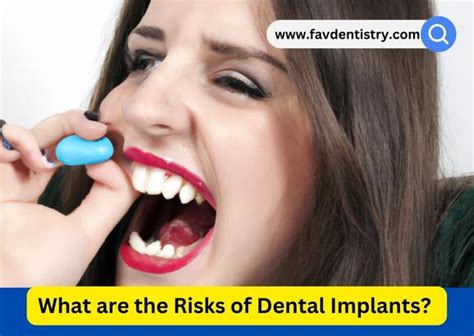 What are the Risks of Dental Implants? - favourite dentistry