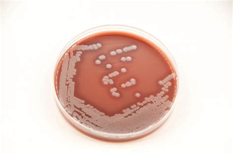 Chocolate Agar - CHOC - Anaerobe Systems