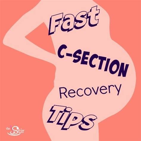 C-Section Recovery: 9 Tips to Help You Heal Faster | Natural birth ...