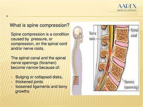 PPT - Spine Decompression Surgery PowerPoint Presentation, free ...