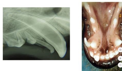 Dental and periodontal pathology Flashcards | Quizlet