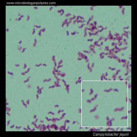 Campylobacter. Gram stain and cell morphology. Campylobacter micrograph, appearance under ...